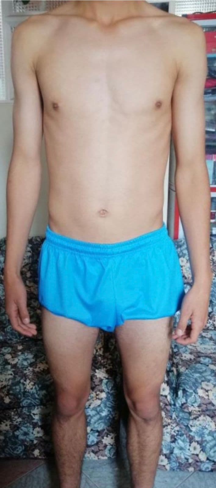 Antes